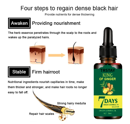 30ml Ginger Hair Care Essential Oil 7 Day Improves Scalp Environment Hair Loss Treatment Hair Growth Care Essence Oil TSLM1 - Amado Deals - wholesale and distributors with free shipping in United States 30ml Ginger Hair Care Essential Oil 7 Day Improves Scalp Environment Hair Loss Treatment Hair Growth Care Essence Oil TSLM1 - Amado Deals - wholesale and distributors with free shipping in United States